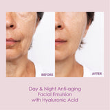 Straser - Hialuronika. Day & Night Anti-aging Facial Emulsion with Hyaluronic Acid - 1.69 Fl. Oz.